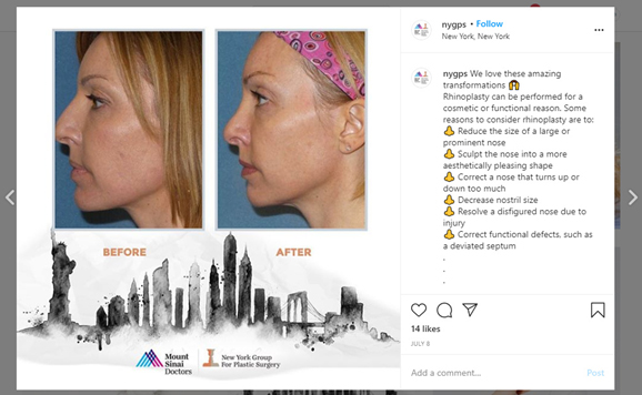 before and after photos